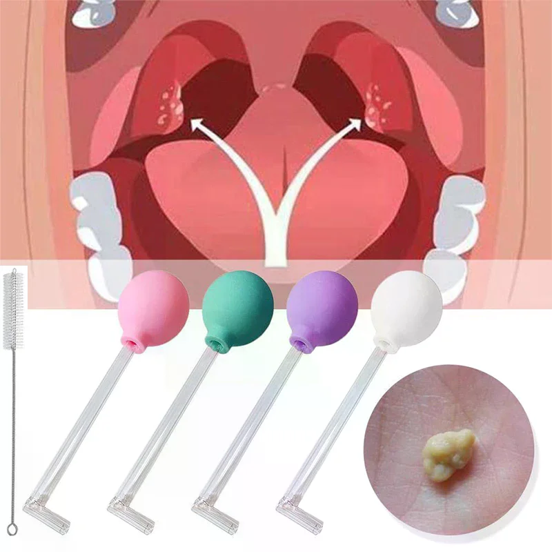 Narzędzie do usuwania kamieni, – Ear Wax Remover recenzja i cena