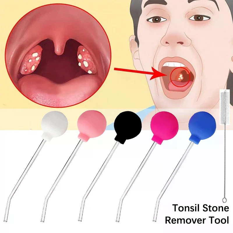 Narzędzie do usuwania kamieni, – Ear Wax Remover recenzja i cena